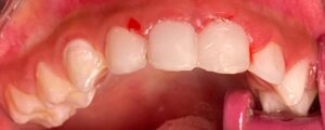 علاج الاسنان بالرياض