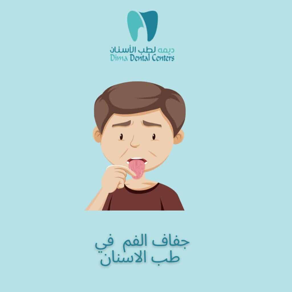 جفاف الفم في طب الأسنان 5 جفاف الفم | ديما لطب الاسنان