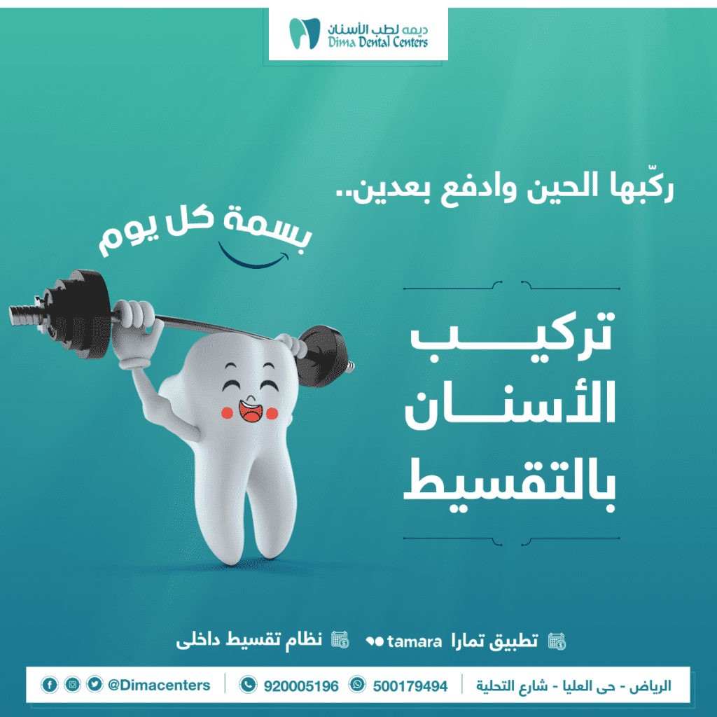 كم سعر تركيب الاسنان بالرياض؟ 14 تركيبات الزيركون للاسنان كم سعر تركيب الاسنان بالرياض؟