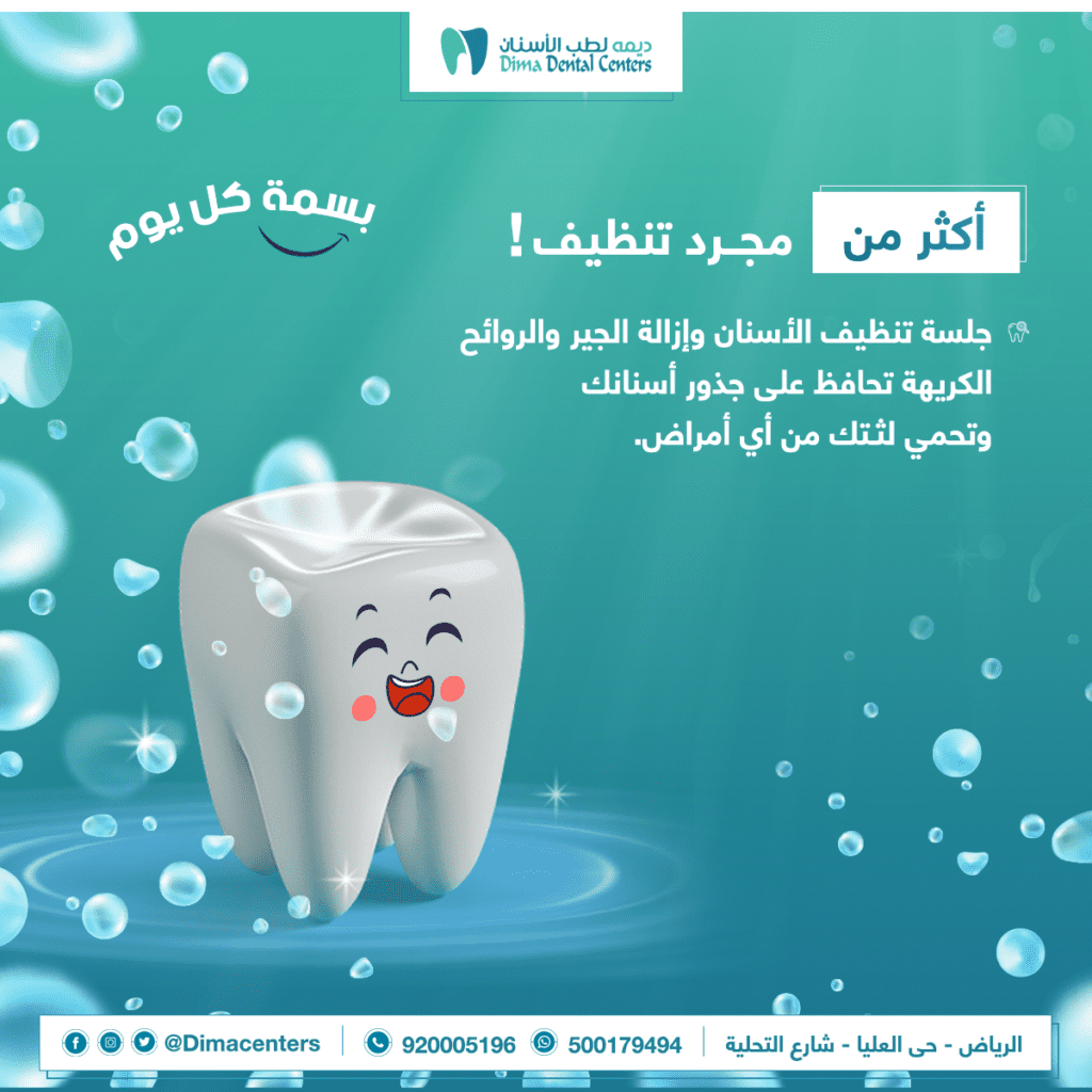 تنظيف تركيبات الاسنان