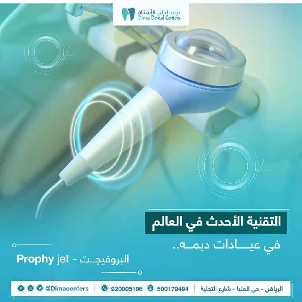 تنظيف الاسنان باستخدام تقنية بProphy Jet Prophy-Jet 3 Prophy Jet | تنظيف الاسنان | ديما