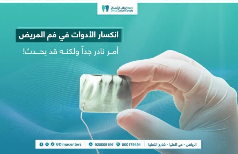 من الحوادث التي تحصل انكسار ادوات الاسنان داخل فم المريض