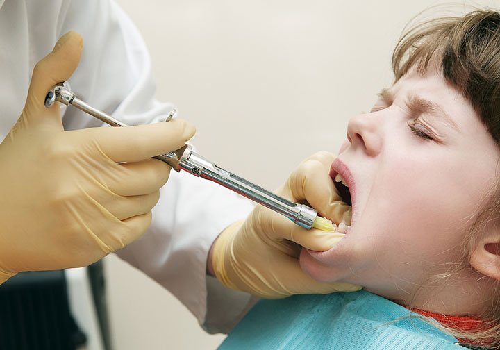التخدير الكامل للاطفال للاسنان - تخدير الاسنان