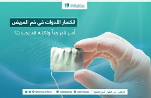 نصائح هامة للعناية بالفم و الأسنان 37 كسر الفايل في الضرس