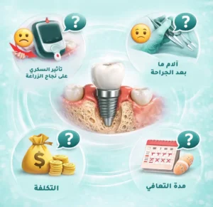 زراعة الأسنان لمرضى السكري