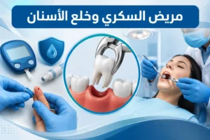 مريض السكري وخلع الأسنان: متى يكون آمنا ومتى يشكل خطرًا؟ 8 مريض السكر وخلع الأسنان