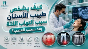 علاج التهاب اللثة بعد سحب العصب